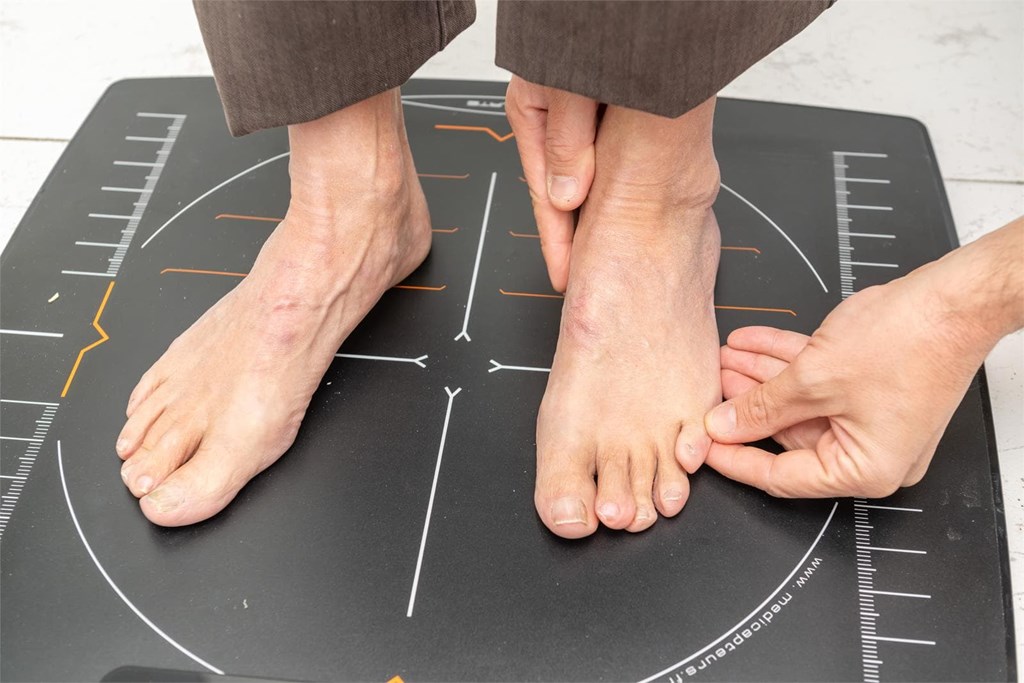 El impacto del calzado inadecuado en las uñas de los pies