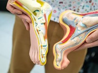 La importancia de revisarse los pies para detectar signos de pie diabético