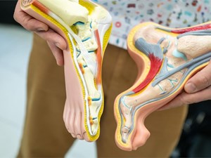 La importancia de revisarse los pies para detectar signos de pie diabético