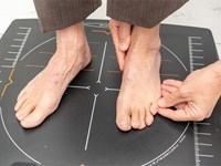 O impacto do calzado inadecuado nas uñas dos pés