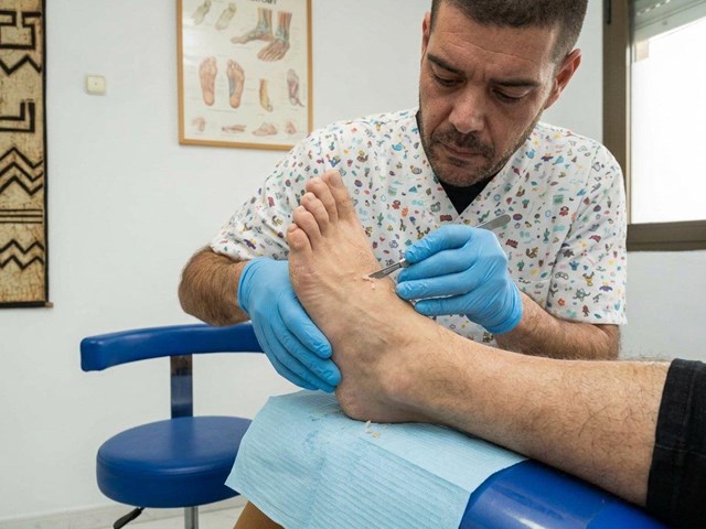 Tratamento de durezas plantares en Celanova